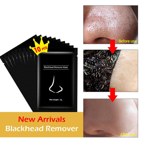 Blackhead Remover Mask